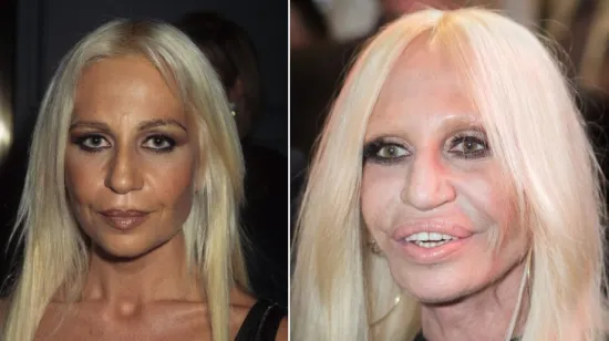 Donatella Versace napravila jednu od najvećih transformacija: Ni majka ju ne bi prepoznala