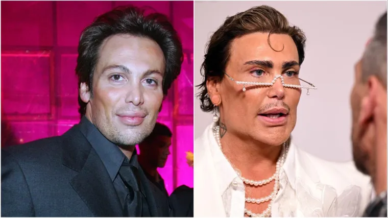 Operirao nos četiri puta, promijenio boju očiju: Neven Ciganović prije je bio druga osoba