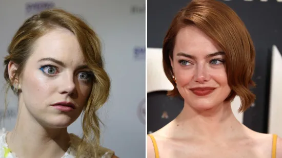 Holivudska slatkica na meti kritika zbog navodnih operacija: Fanovi tvrde da je neprepoznatljiva